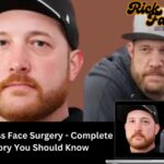 Rick Ness Face Surgery - Complete Story You Should Know