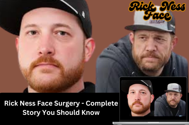 Rick Ness Face Surgery - Complete Story You Should Know